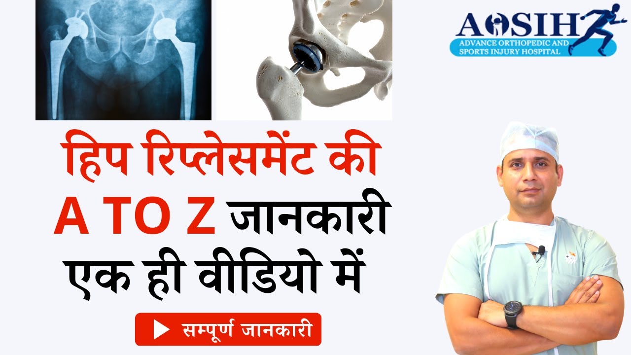complete information about hip joint change / cost/ method / best