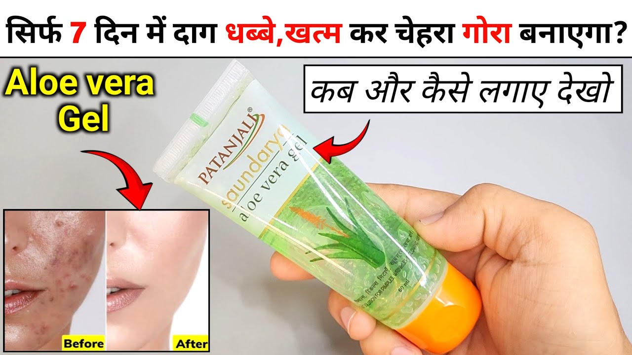 Aloe vera gel for face | patanjali saundarya aloe vera gel review | aloe vera gel