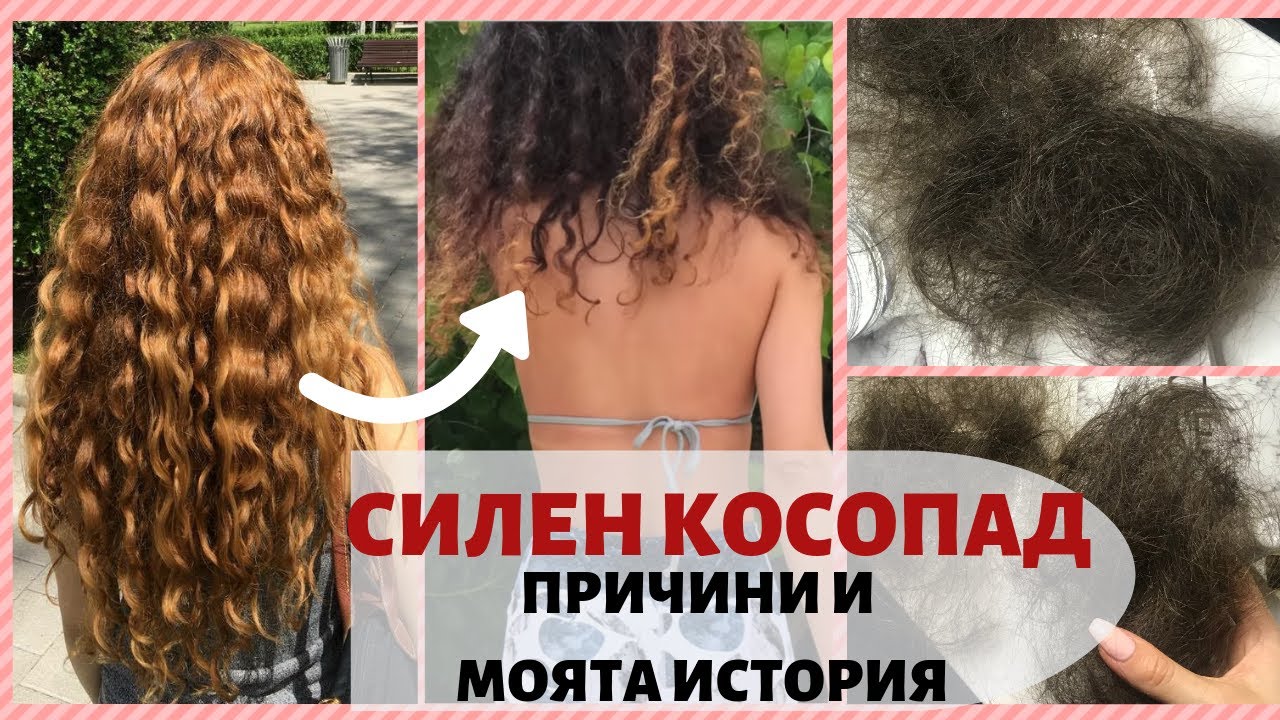 КОСОПАД - ПРИЧИНИ И МОЯТ ОПИТ | Част 1