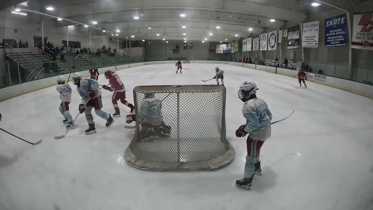 CAPS VS SOO
