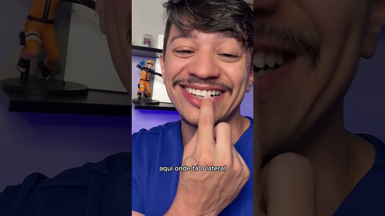 O dente dele t&aacute; muito mole com o Aparelho! Vai Cair?? #shorts