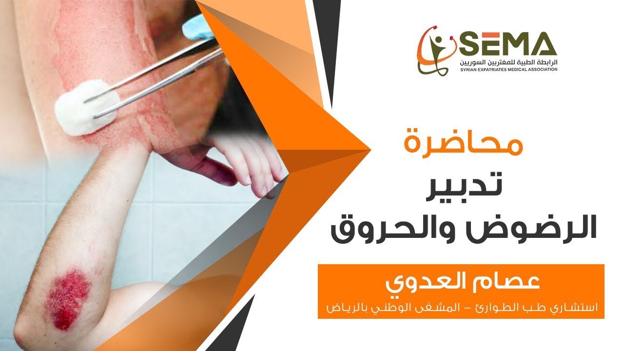 تدبير الرضوض والحروق الدكتور المحاضر عصام العدوي استشاري طب طوارئ
