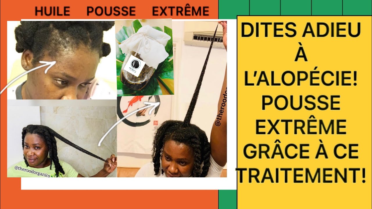 🌿#43. HUILE POUSSE EXTRÊME- ALOVEDA, le traitement anti alopécie! pousseextrême#volume#roodorganics
