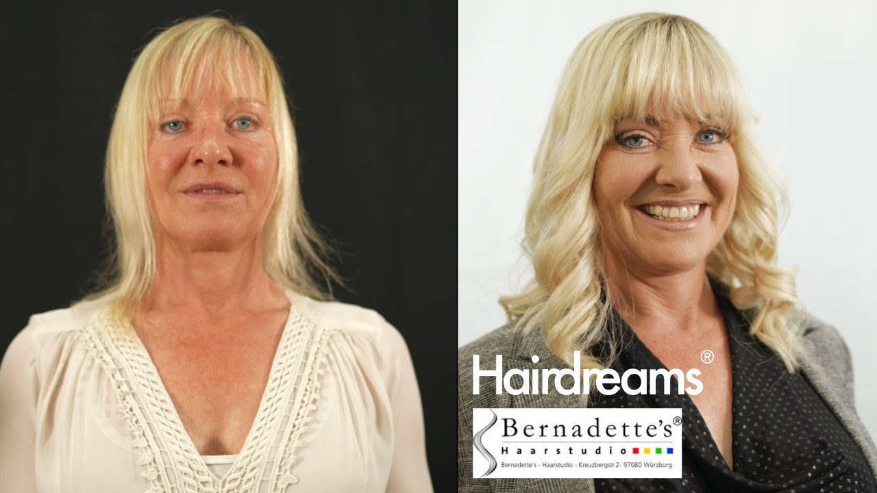 Haarverdichtung und Haarverlängerung mit Echthaar von Hairdreams bei Haarausfall