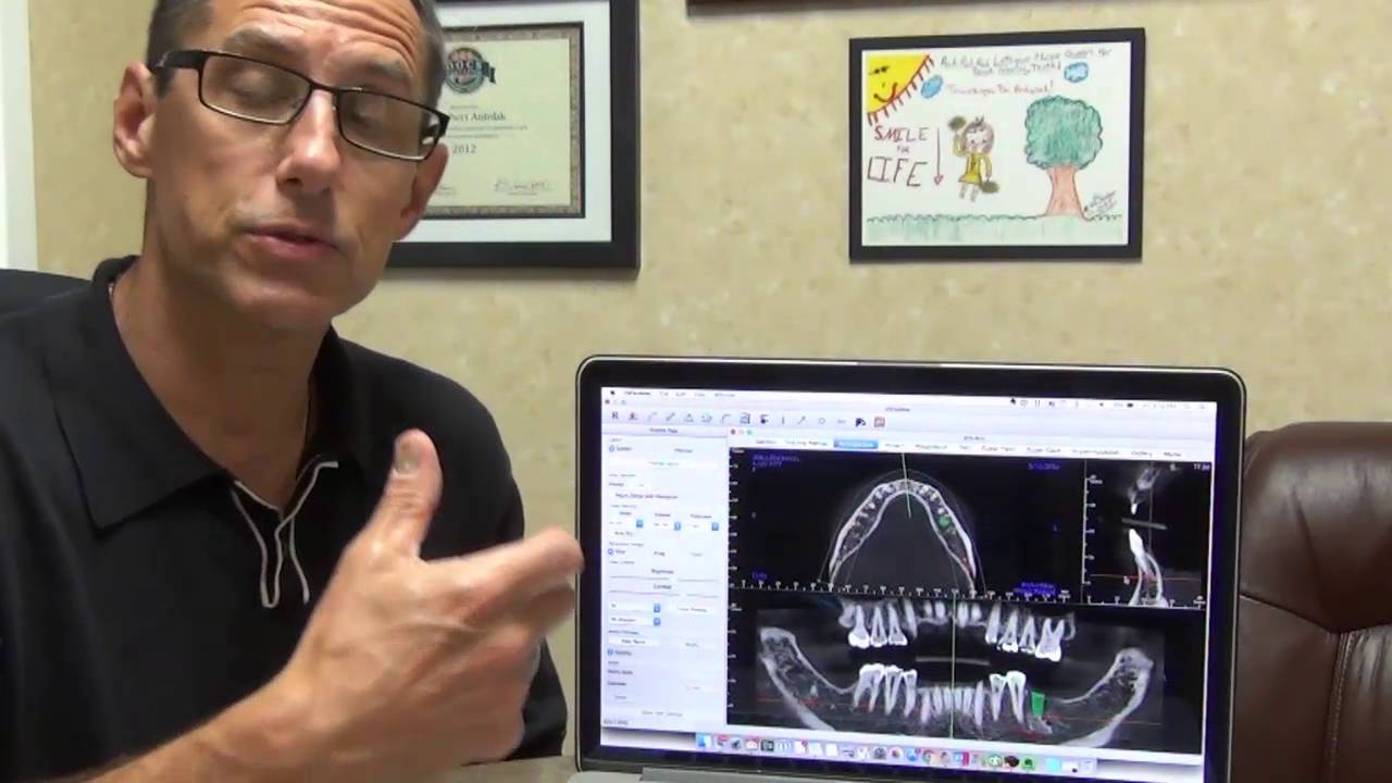 3D Cone Beam CT Scan Dental Benefits - Shelby Township Dentist