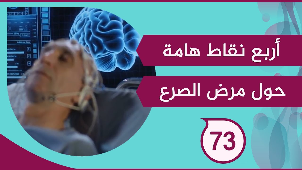 أربع نقاط هامة حول مرض الصرع ؟