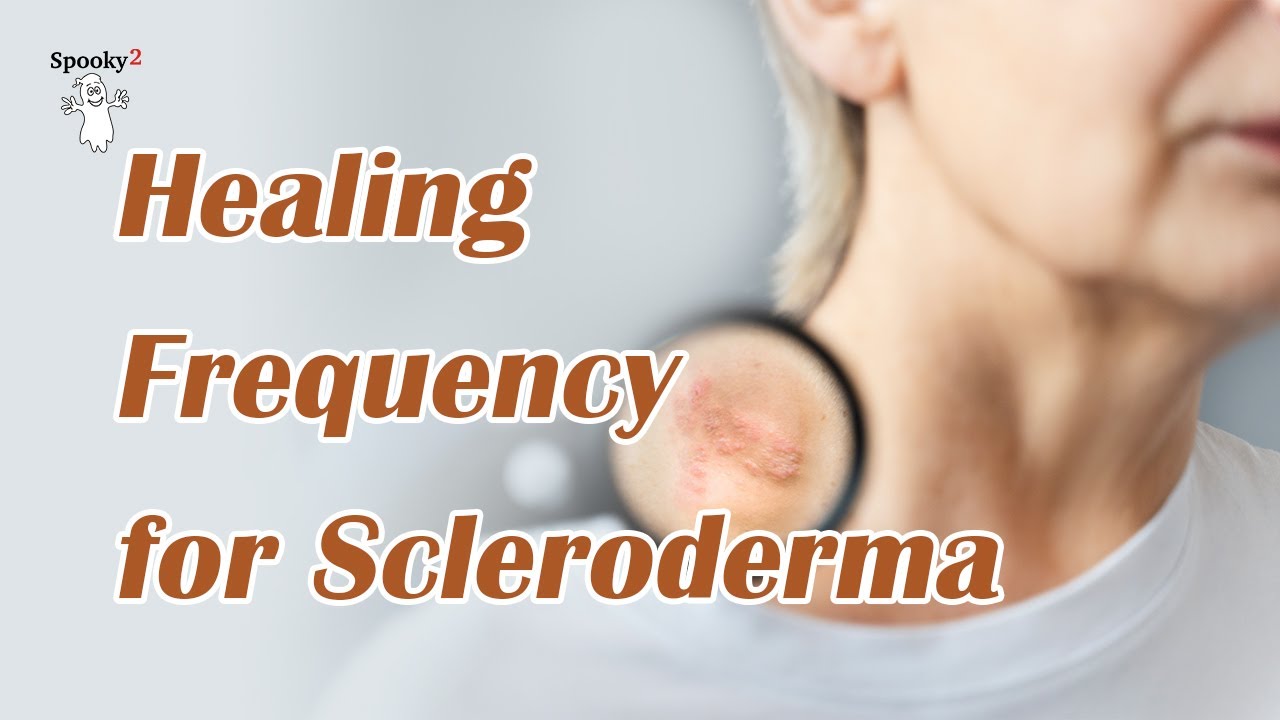 Hard Skin MELTDOWN! | Skin Softening Rife Freq for Scleroderma & Autoimmune Repair