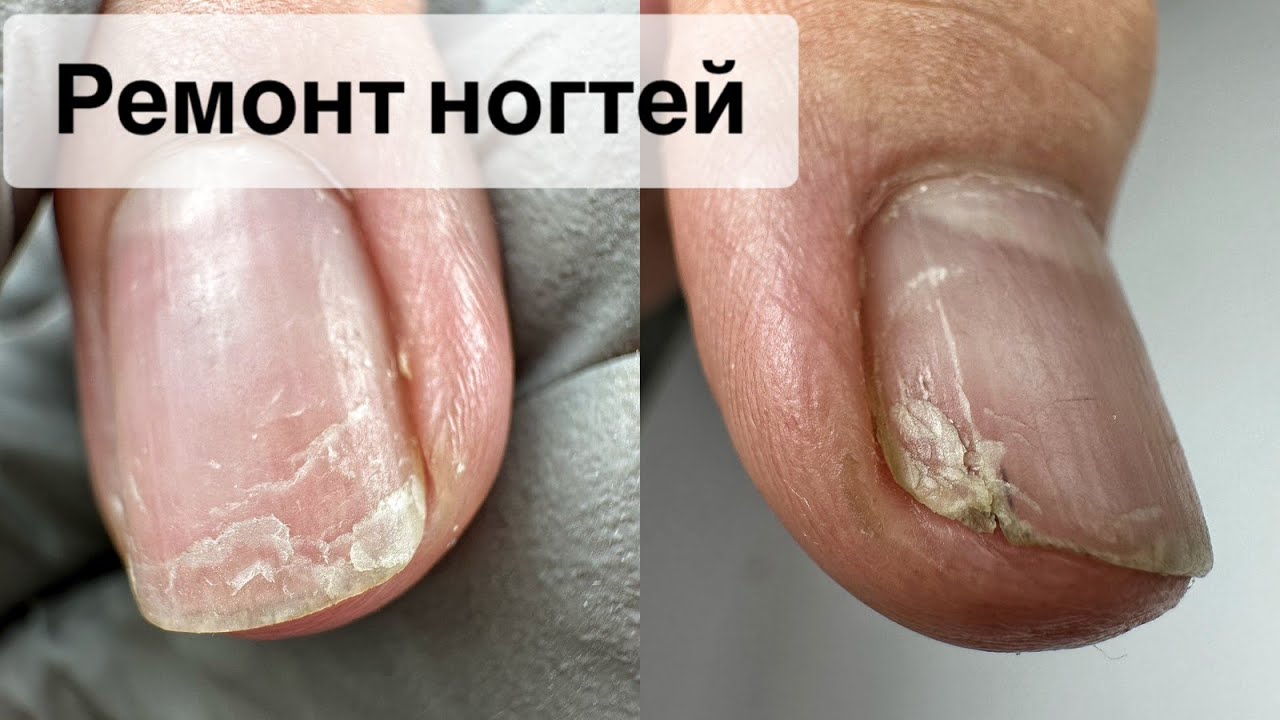 МАНИКЮР ОНЛАЙН. ГЕЛЕВЫЕ ТИПСЫ. ОПИЛ ЧЕТКОГО КВАДРАТА. Виктория Авдеева