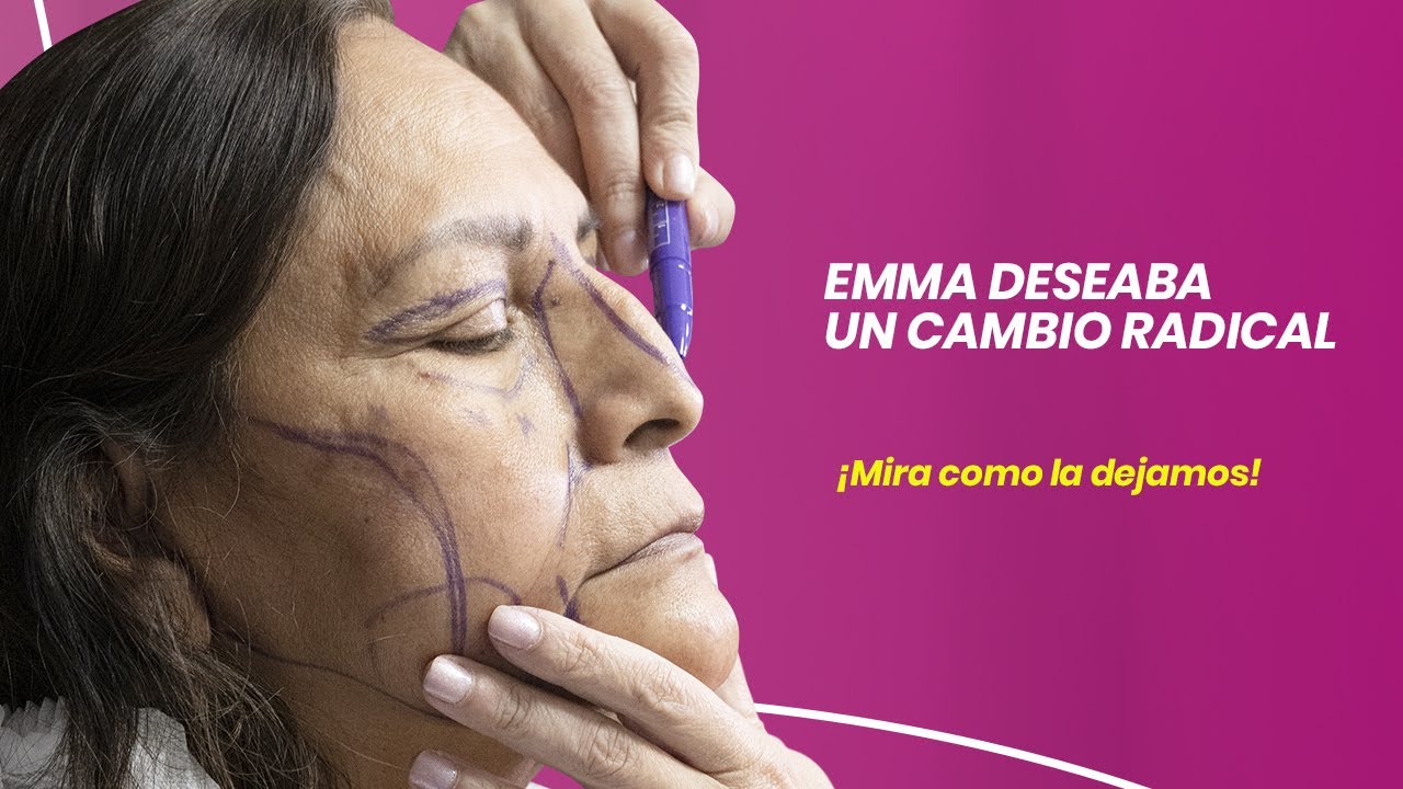 EMMA DESEABA UN CAMBIO RADICAL ¡MIRA COMO LA DEJAMOS!