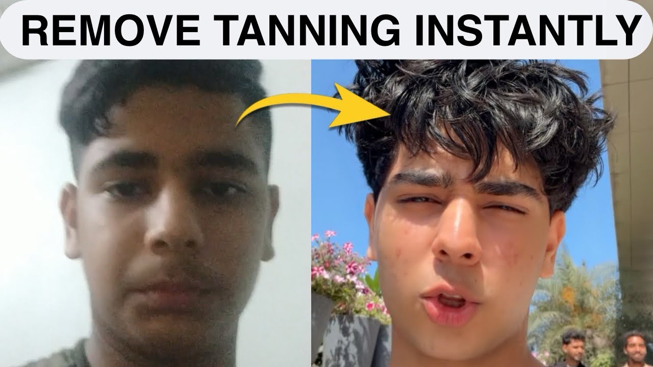 HOW TO REMOVE SUN TAN FAST |PRECAUTIONS | NATURAL REMEDIES |EVERYTHING ABOUT TANNING |