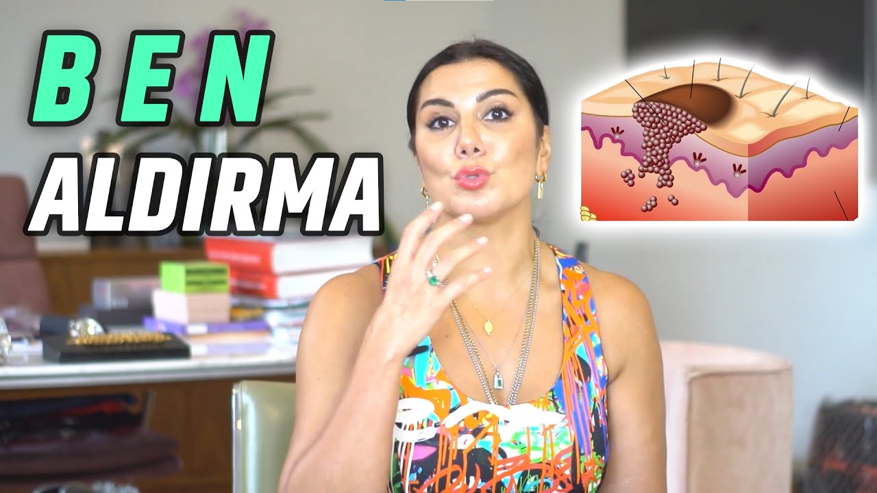 BEN ALIMI NASIL YAPILIR? BEN ALDIRMA!