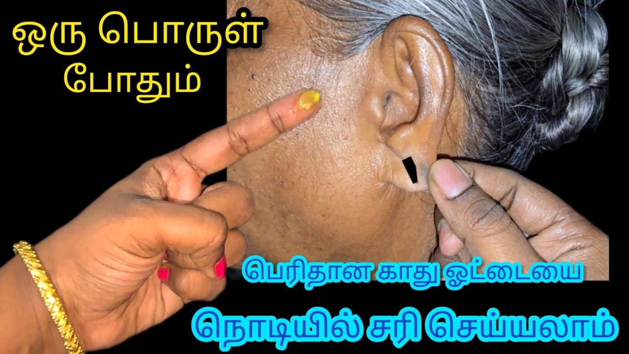 ஒரு பொருள் போதும் நொடியில் பெரிய காது ஓட்டை சிறியதாகும் /Kitchentips in Tamil/@Nalini Manick Cooking