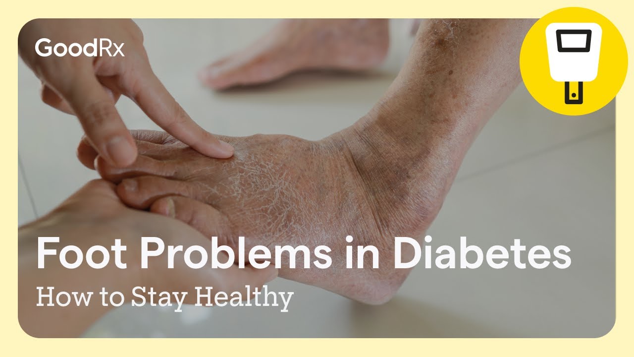 Foot Problems in Diabetes: How to Stay Healthy | GoodRx
