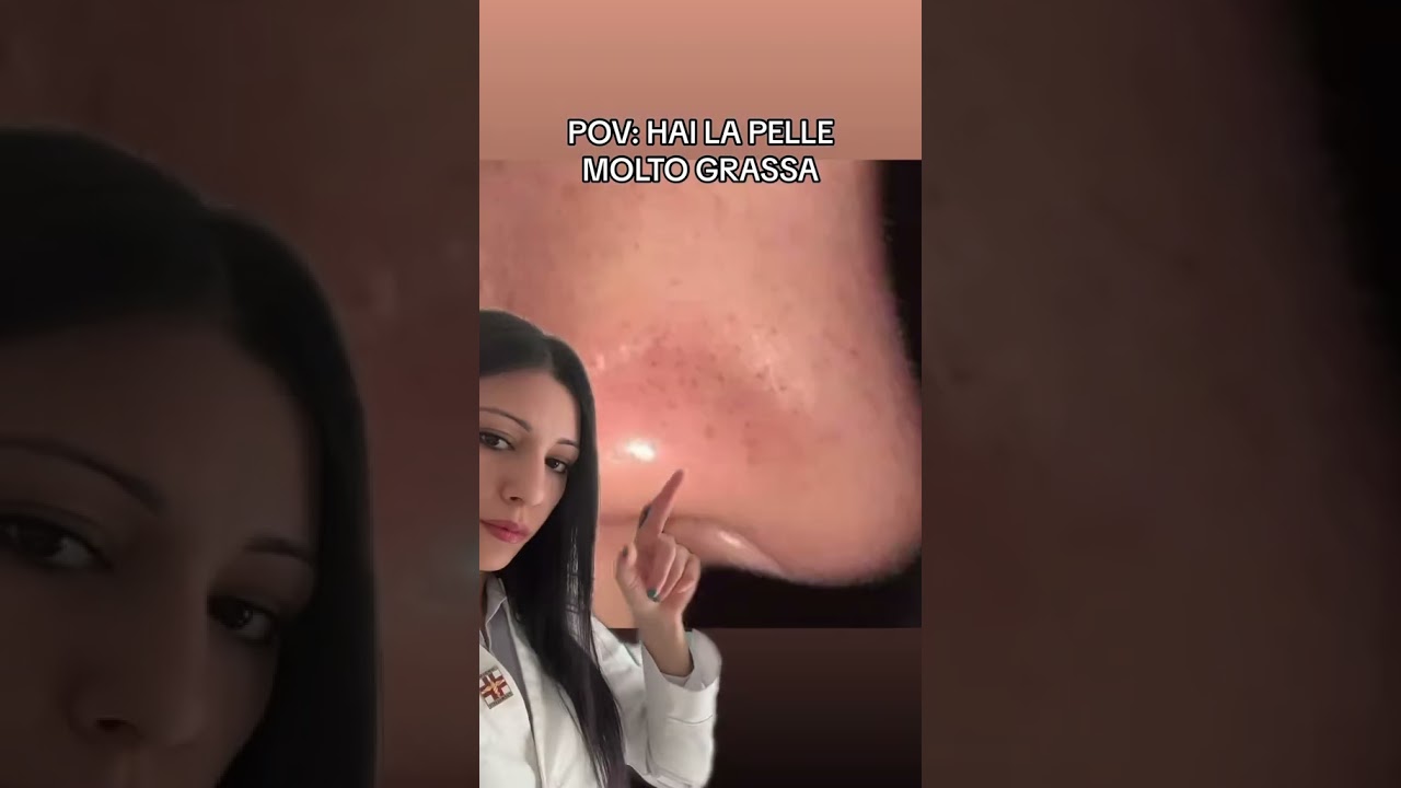 Pelle Grassa 💦