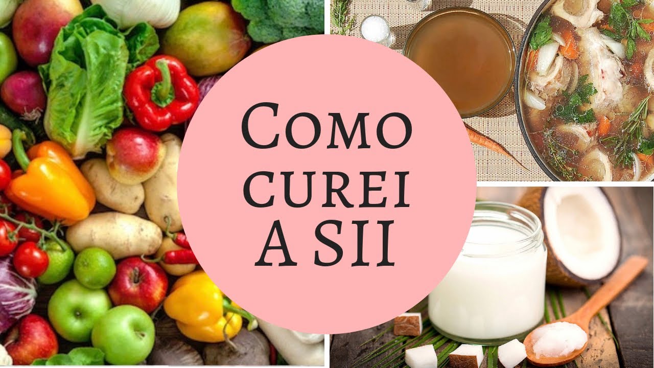 MELHORES ALIMENTOS PARA SII \ MINHA CURA