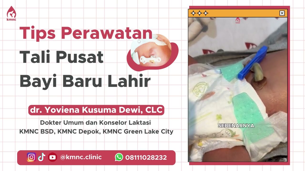 TIPS PERAWATAN TALI PUSAT BAYI BARU LAHIR!