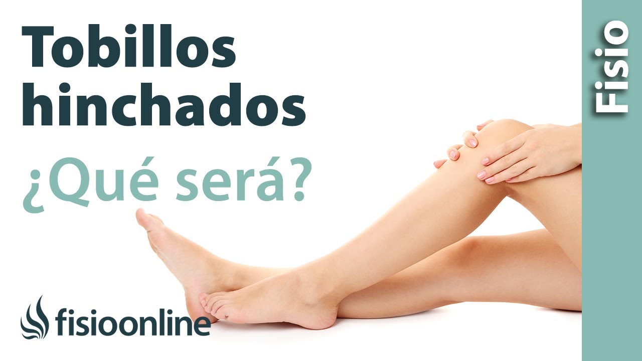 ¿Tienes los tobillos y piernas hinchadas? - ¿Será edema venoso o linfático?