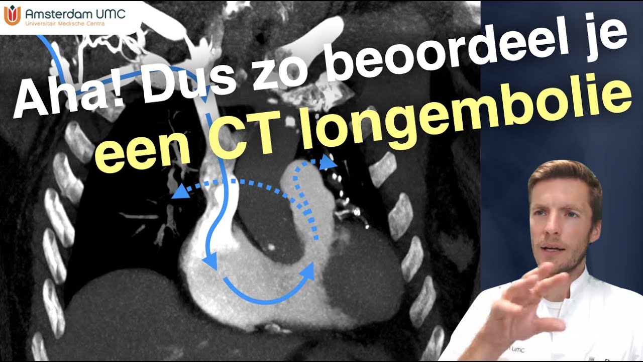 CT Longembolie