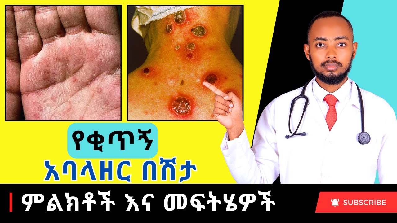 Ethiopia | የቂጥኝ አባላዘር በሽታ ምልክቶች እና መፍትሄዎች
