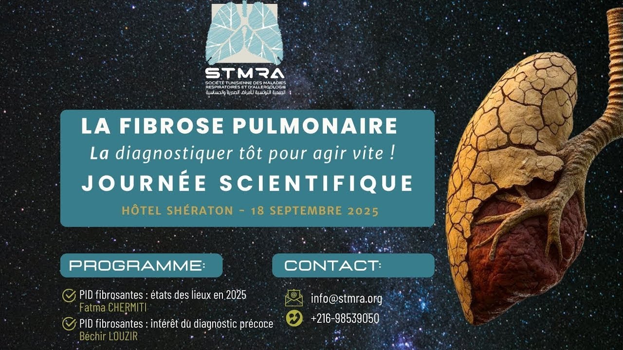 La fibrose pulmonaire, la diagnostiquer tôt pour agir vite !