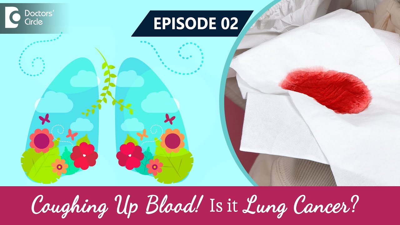 Coughing Up Blood (Hemoptysis)| Is it Lung Cancer? Visit a doctor | Dr.Sandeep Nayak & Dr.Bharath G.