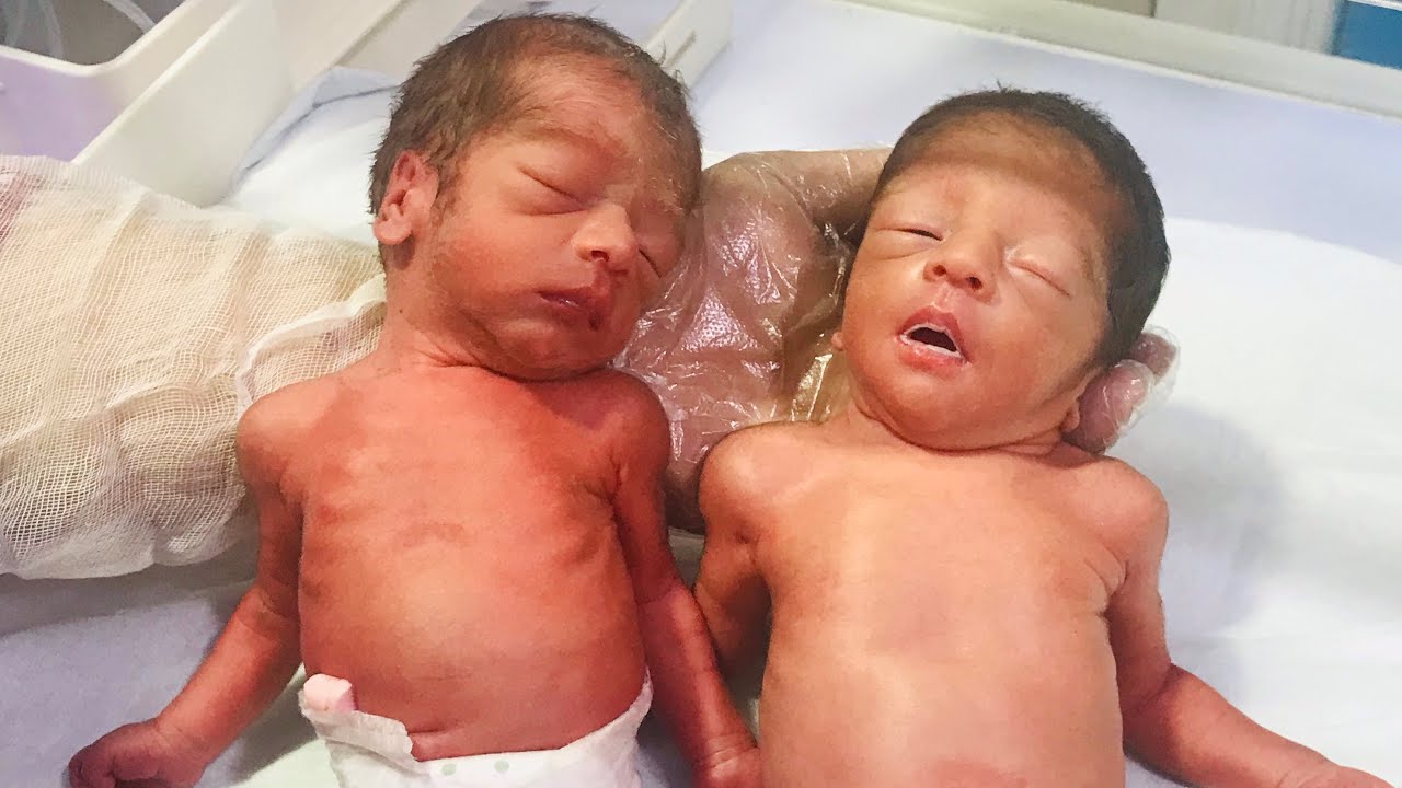 Feeding Premature Twins in NICU | Adorable & Delicate Moments of Care 🍼👶👶