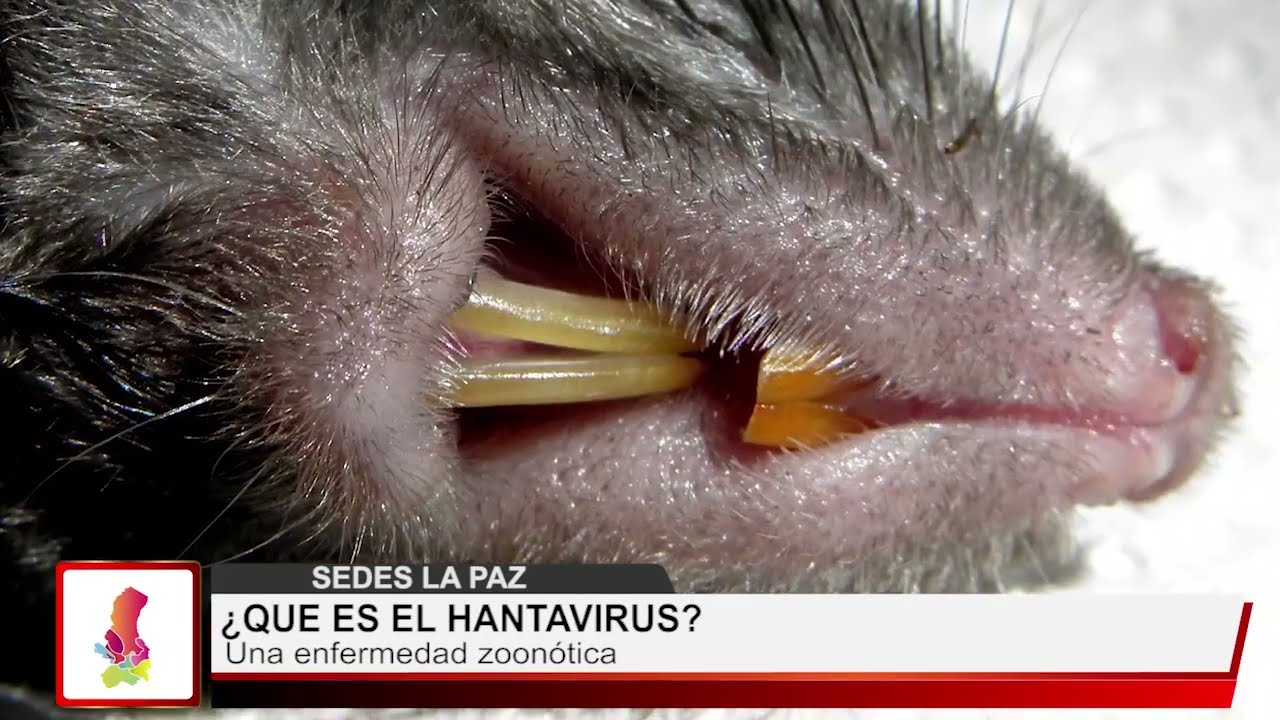 ¿QUÉ ES EL HANTAVIRUS?