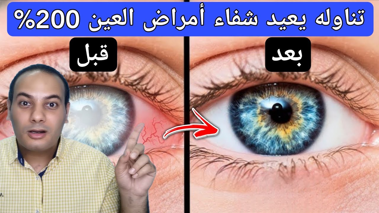خليط سحري يشفي امراض العين يمنع العمي يعيد النظر لأكثر من 200 % ولكن بشرط/أفضل فيتامين لضعف النظر!