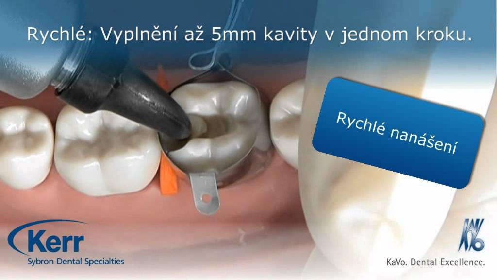 SonicFill (CZ)