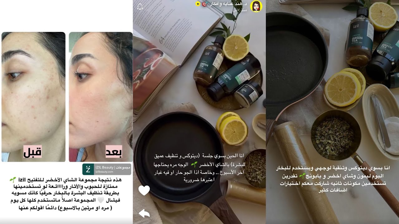 مجموعة الشاي الأخضر للتفتيح من Izil ممتاز للحبوب والآثار رائع | د.هند عنايه وأفكار 🎀