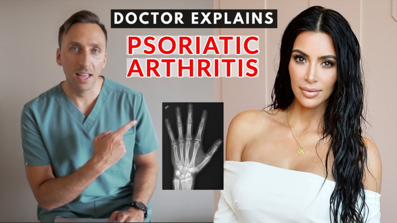 DOCTOR Explains Kim Kardashian's Arthritis Scare