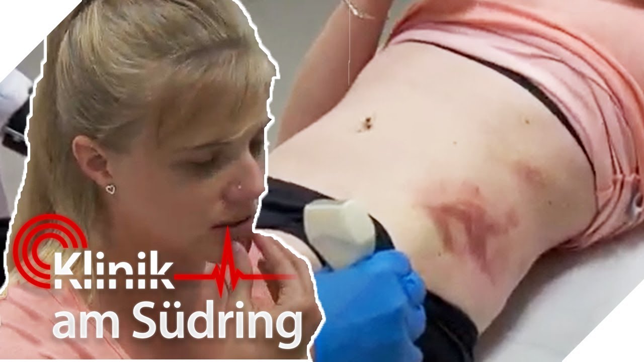 Starke H&uuml;ftschmerzen! Wovon kommen die H&auml;matome?  | Klinik am S&uuml;dring | SAT.1