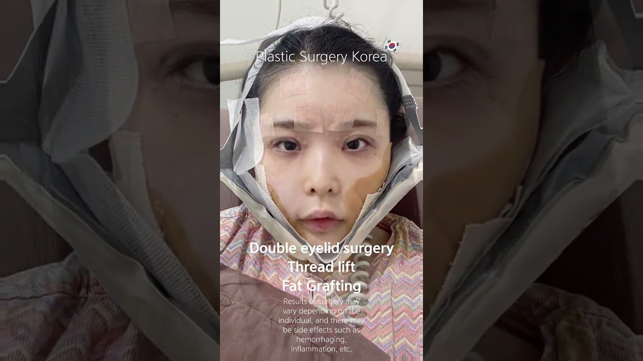 [Plastic Surgery Korea]  #viewplasticsurgery #plasticsurgerykorea