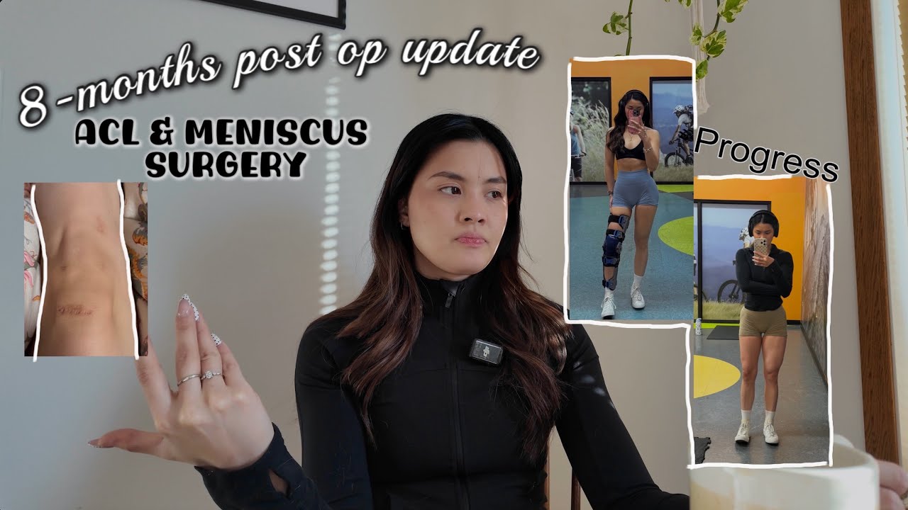 8 MONTHS POST-OP ACL & MENISCUS SURGERY: recovery timeline & advice! 💪🏻🩹❤️&zwj;🩹