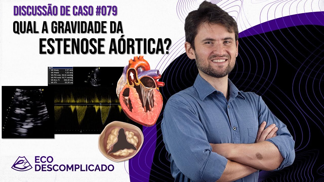 EcoDescomplicado - Discussão de caso #079 - Qual a gravidade da Estenose Aórtica?