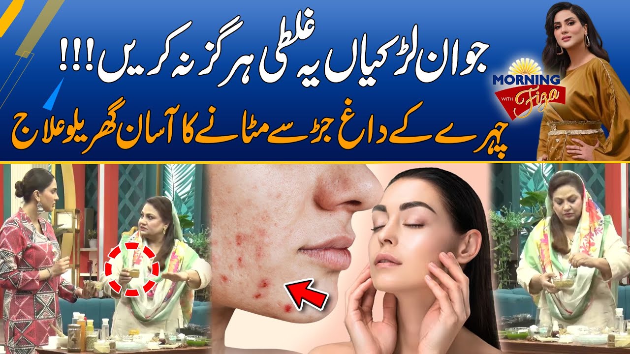 Don't Do This Mistake - Home Remedy For Acne Removal | Morning With Fiza Ali