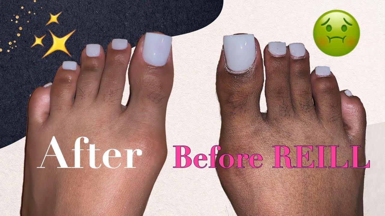 How To: Refill Acrylic Toes | LASTED FOR 1 MONTH!!!