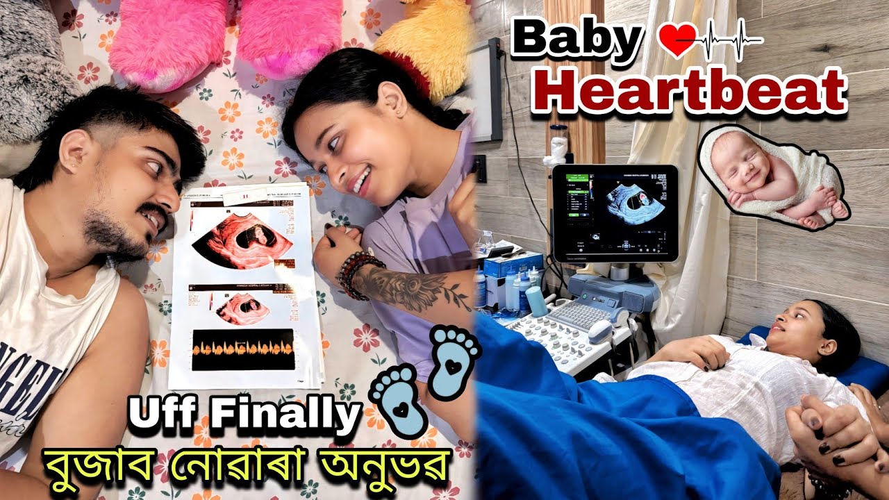 Baby Heartbeat👣💓// Uff Finally বুজাব নোৱাৰা অনুভৱ...