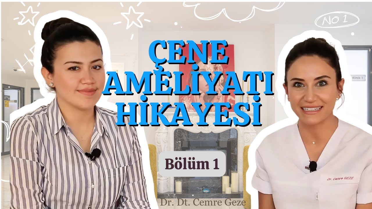 Çene Ameliyatı Hikayeleri 1