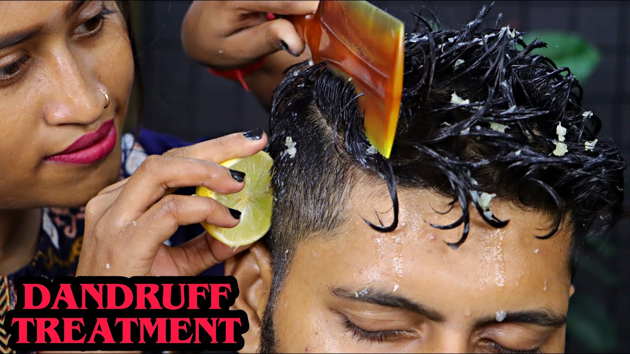 How to Remove Dandruff Permanently | Dandruff Removal Treatment by Barber Girl Pakhi | ASMR