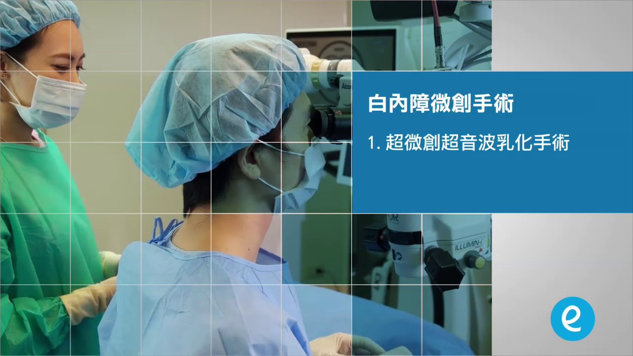 白內障手術治療方式(超音波乳化術 vs 飛秒白內障雷射)