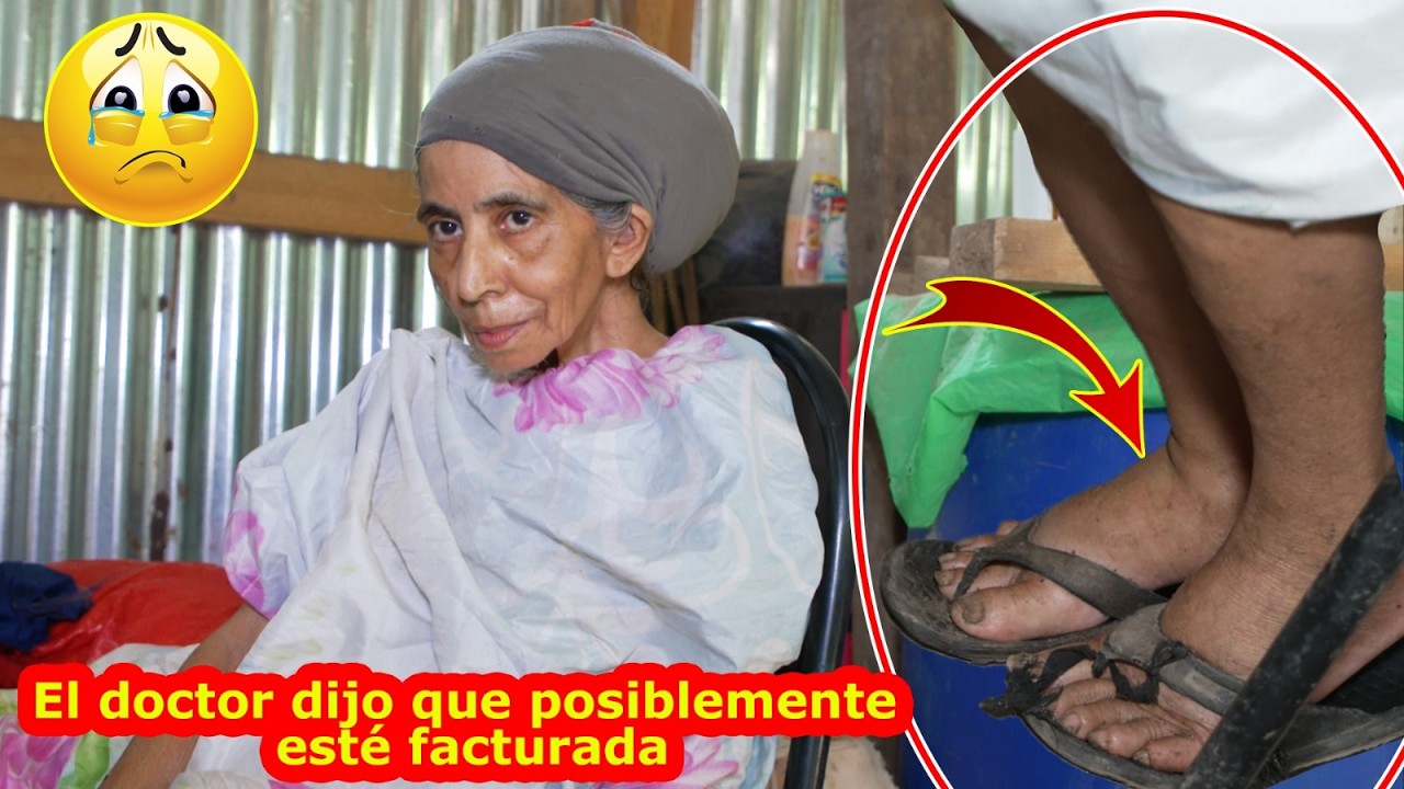 Doña Evita nos cuenta como fue la caída, posiblemente esté fracturada - Ediciones Mendoza