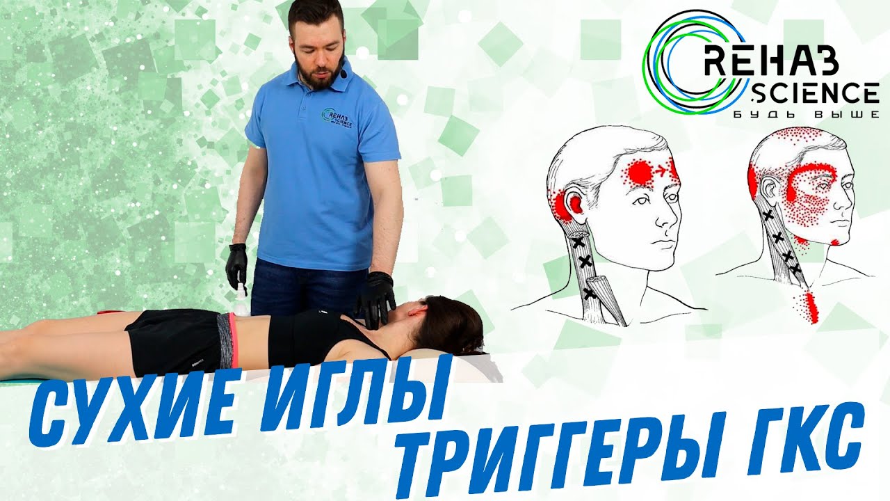 Метод сухие иглы на ГКС.