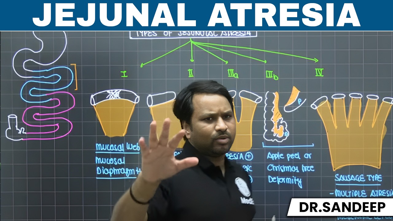 Jejunal Atresia | Small Intestines  | Surgery | Bailey learned with Dr. Sandeep