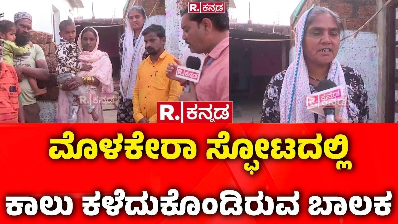 Massive Blast in Bidar | ಮೊಳಕೇರಾ ಸ್ಫೋಟದಲ್ಲಿ ಕಾಲು ಕಳೆದುಕೊಂಡಿರುವ ಬಾಲಕ