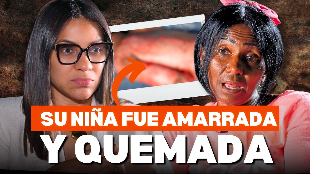 Niña de 9 años SOBREVIVIÓ QUEMADURAS con gasolina, pero VIVE EN AGONÍA