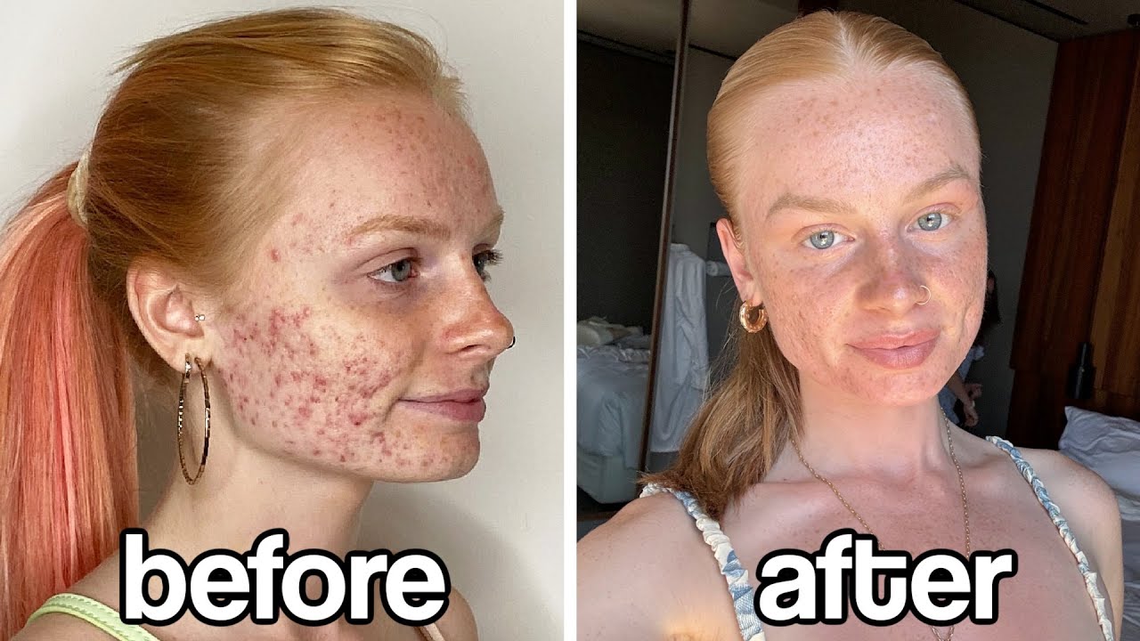 I Quit Makeup For 9 Months...