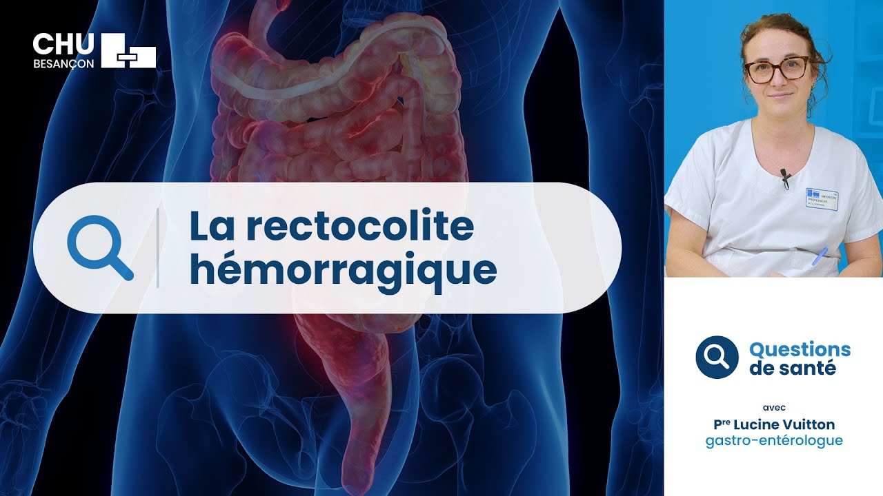 Rectocolite hémorragique : symptômes, conseils alimentaires, traitements