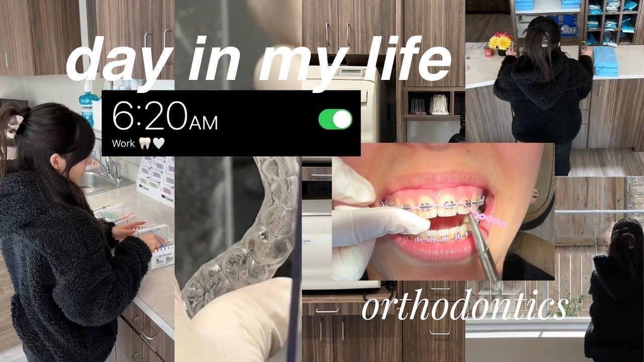 day in my life (orthodontics) + braces adjustment