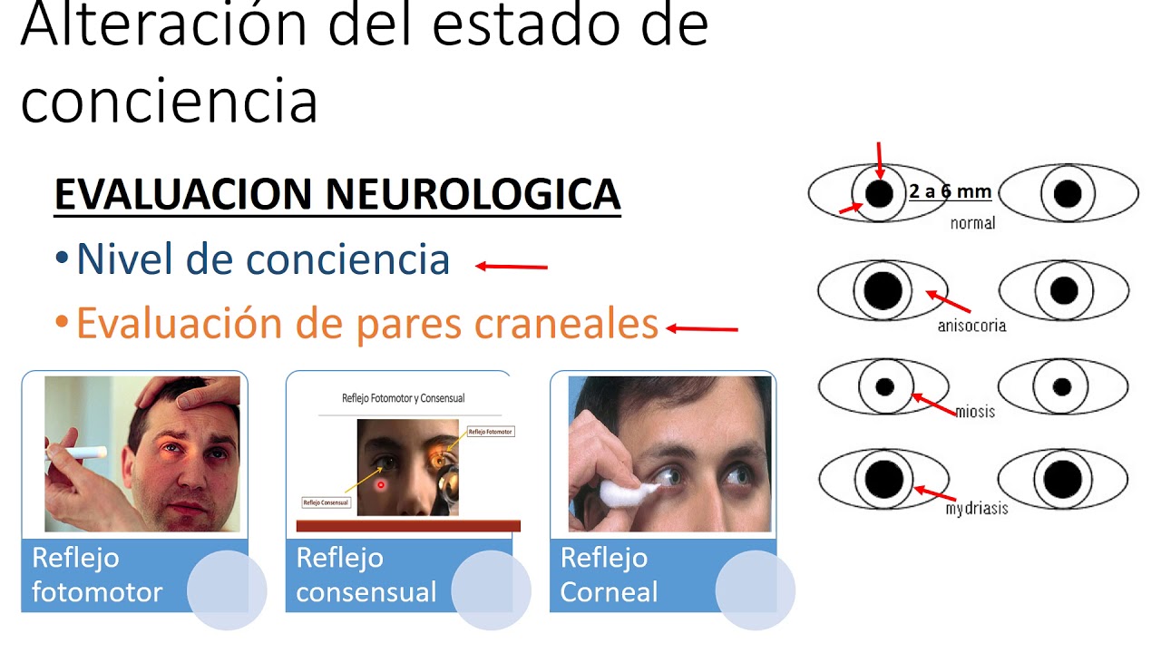 Clase 11 Alteración de la conciencia